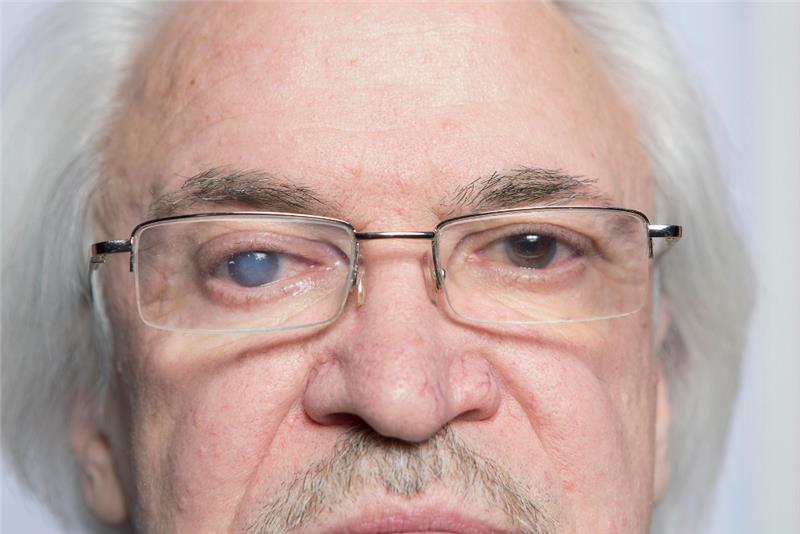Blurry vision and other cataract symptoms may require surgery